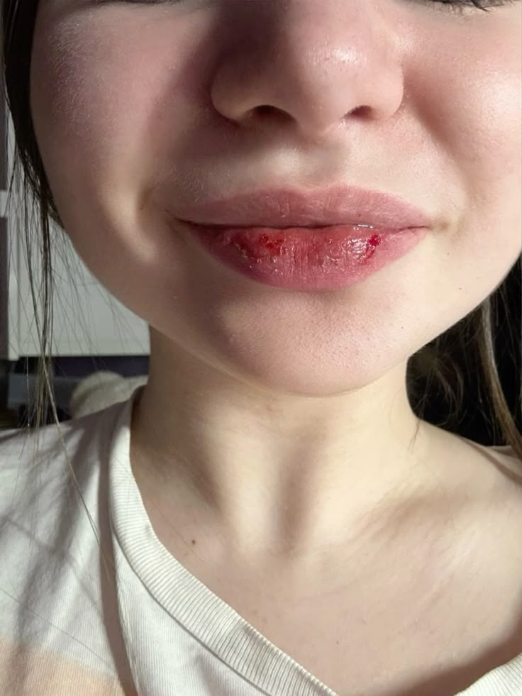 1. Liếm môi không giúp môi ẩm hơn – ngược lại còn làm tình hình tệ đi