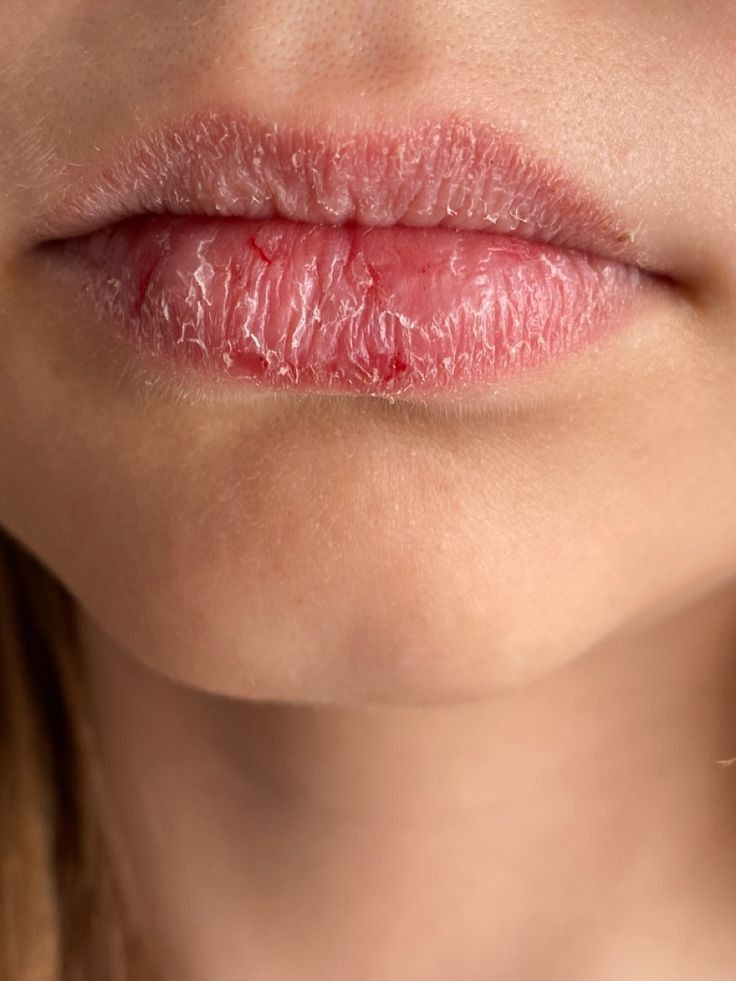 5. Đừng quên chống nắng cho môi