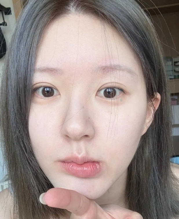 Triệu Lộ Tư cấp ẩm nhiều lớp
