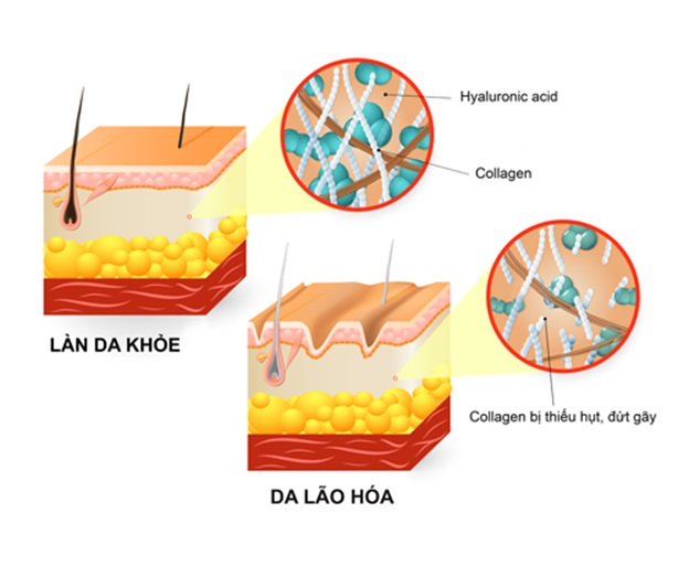 Collagen và Hyaluronic Acid: Khác nhau như thế nào?