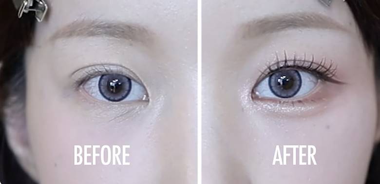 Mở rộng vùng quanh mắt để giảm khoảng trống