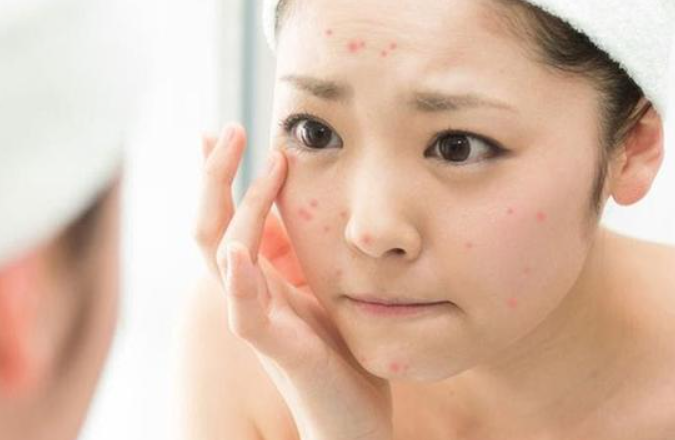 Không lạm dụng nước hoa hồng khi chăm sóc da